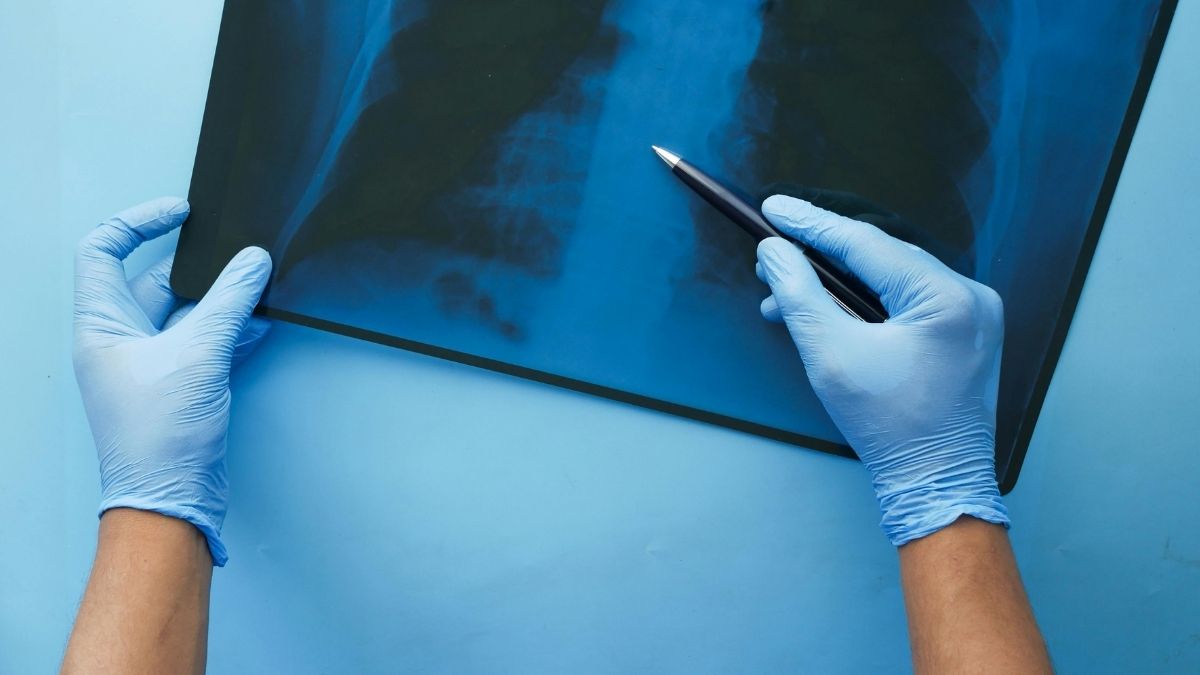 Zdravstveni problem, zdravlje Pexels